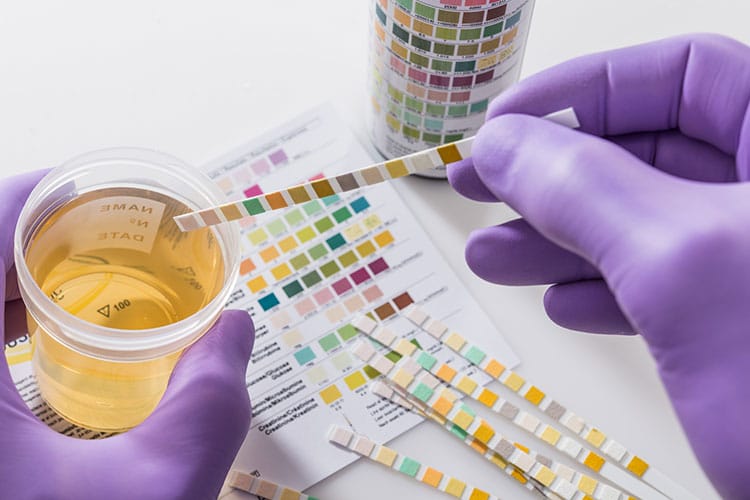 conducting drug test using urine samples